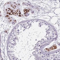 SLC35E4 Antibody, Novus Biologicals 25 &mu;L, Unlabeled:Antibodies, Polyclonal